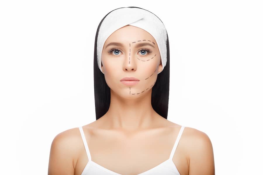 Rhinoplasty Surgery