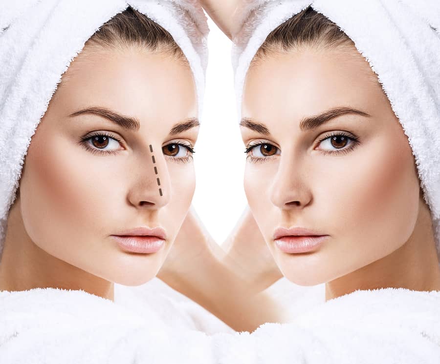 Two views of a woman's face in towel wraps, with a dotted line drawn along the bridge of the nose in one