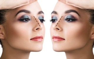 rhinoplasty surgery