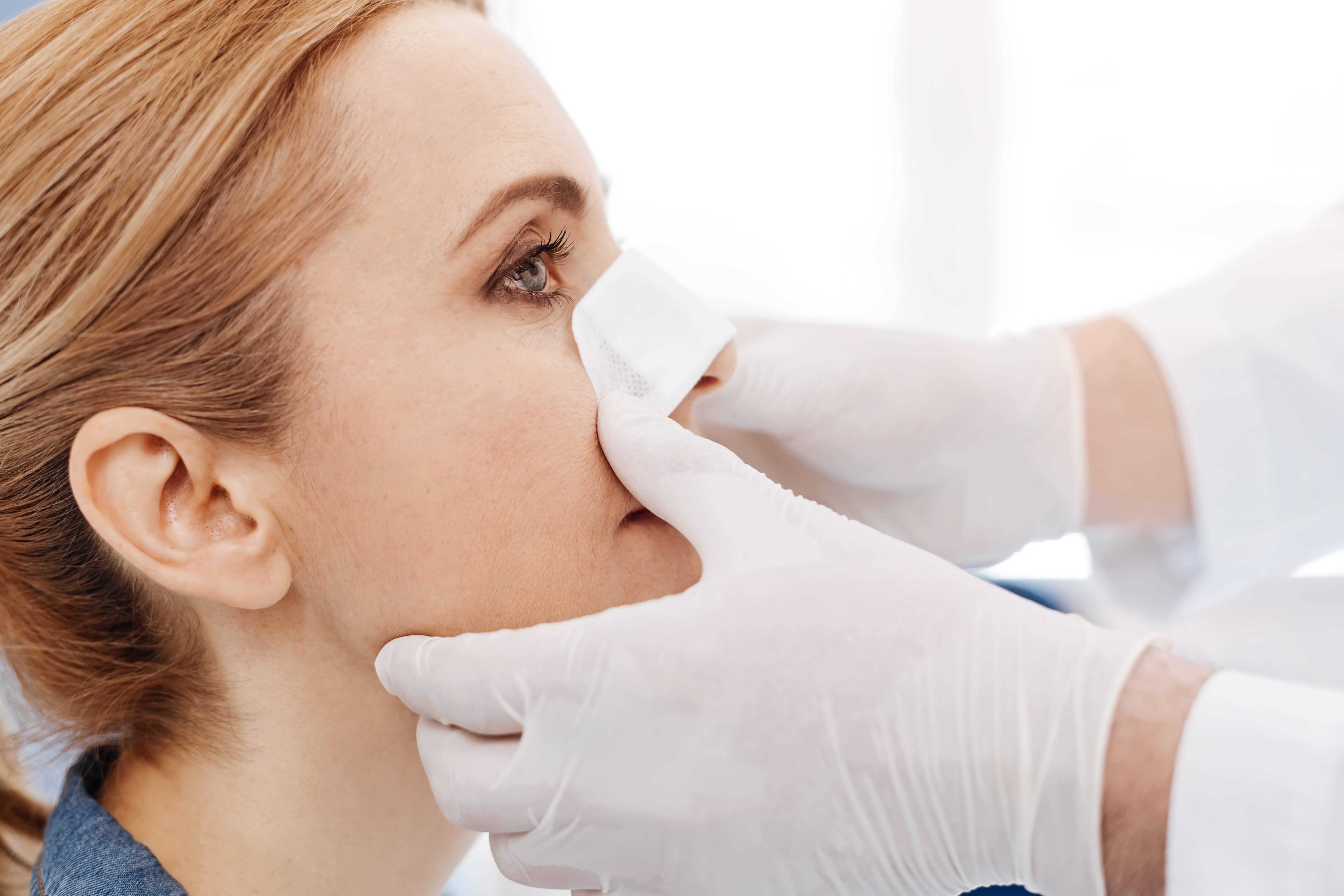 how to take care of your nose after rhinoplasty