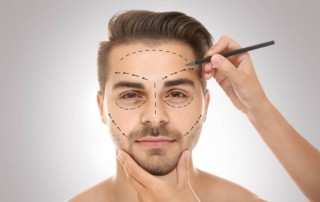 Male Rhinoplasty