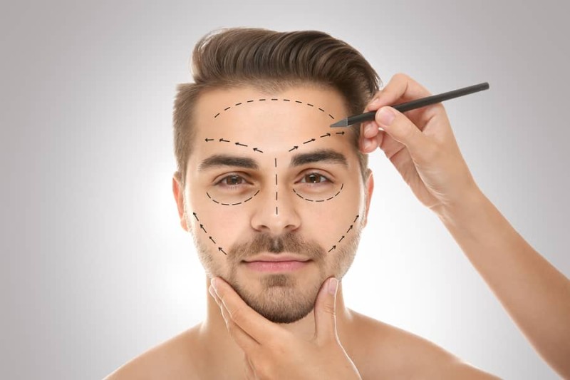 Male Rhinoplasty