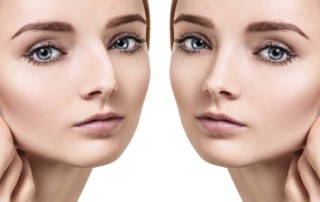 Miami Nose Plastic Surgery